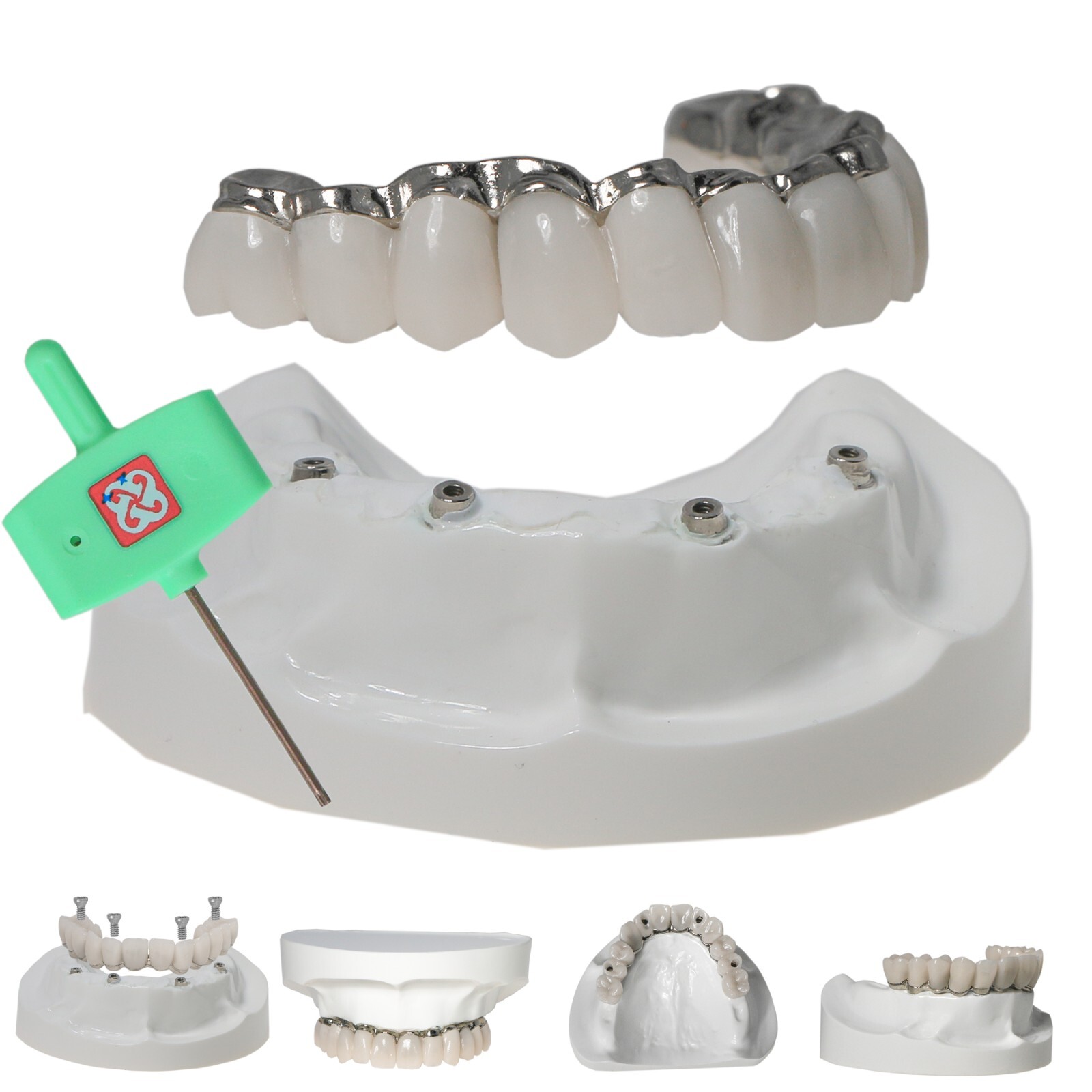 Dental Implant Model Upper Lower Jaw Demo All on 4/6 Overdenture treatment model