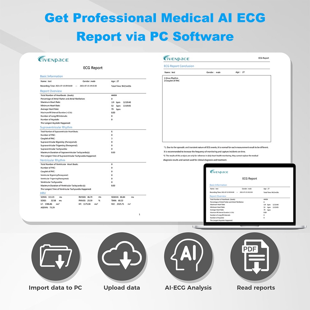 AI Holter Monitor 24 Hrs Chest Strap EKG Monitor with Free AI Analysis PC Report