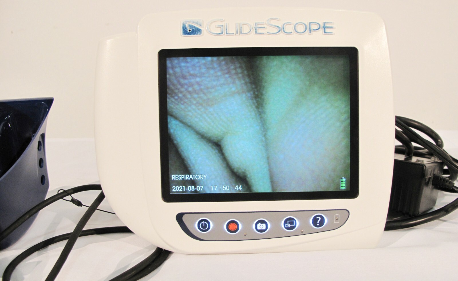 Verathon Glidescope Cobalt AVL Monitor with 3-4 Adult Video Baton Laryngoscope