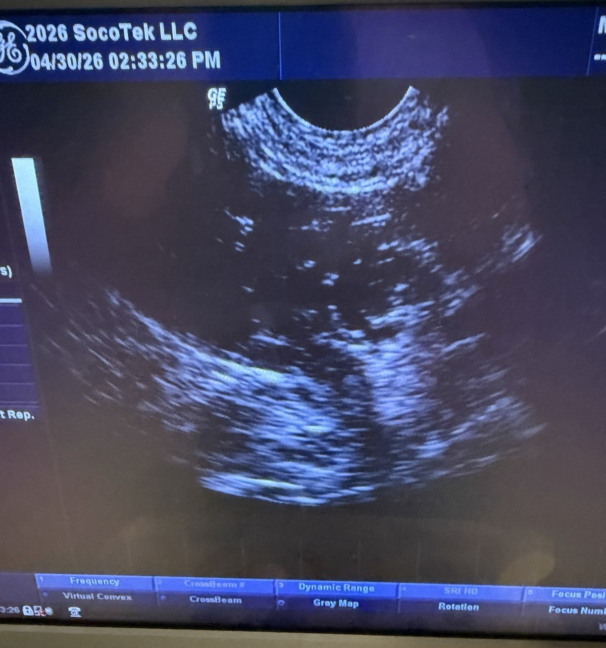 GE Healthcare E8C Endocavitary Ultrasound Probe 2297883 Obstetrics Radiology