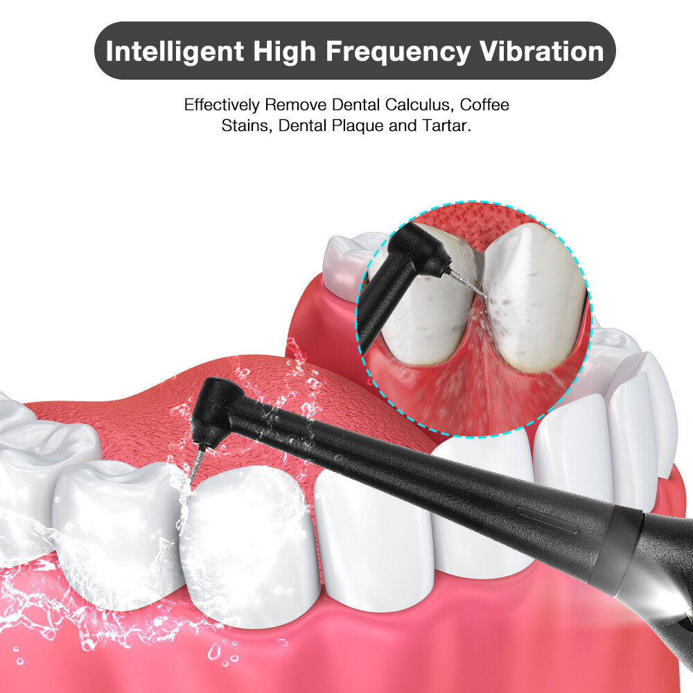 Ultrasonic Dental Scaler Calculus Tartar Remove Teeth Clean Tool Tooth Whitening