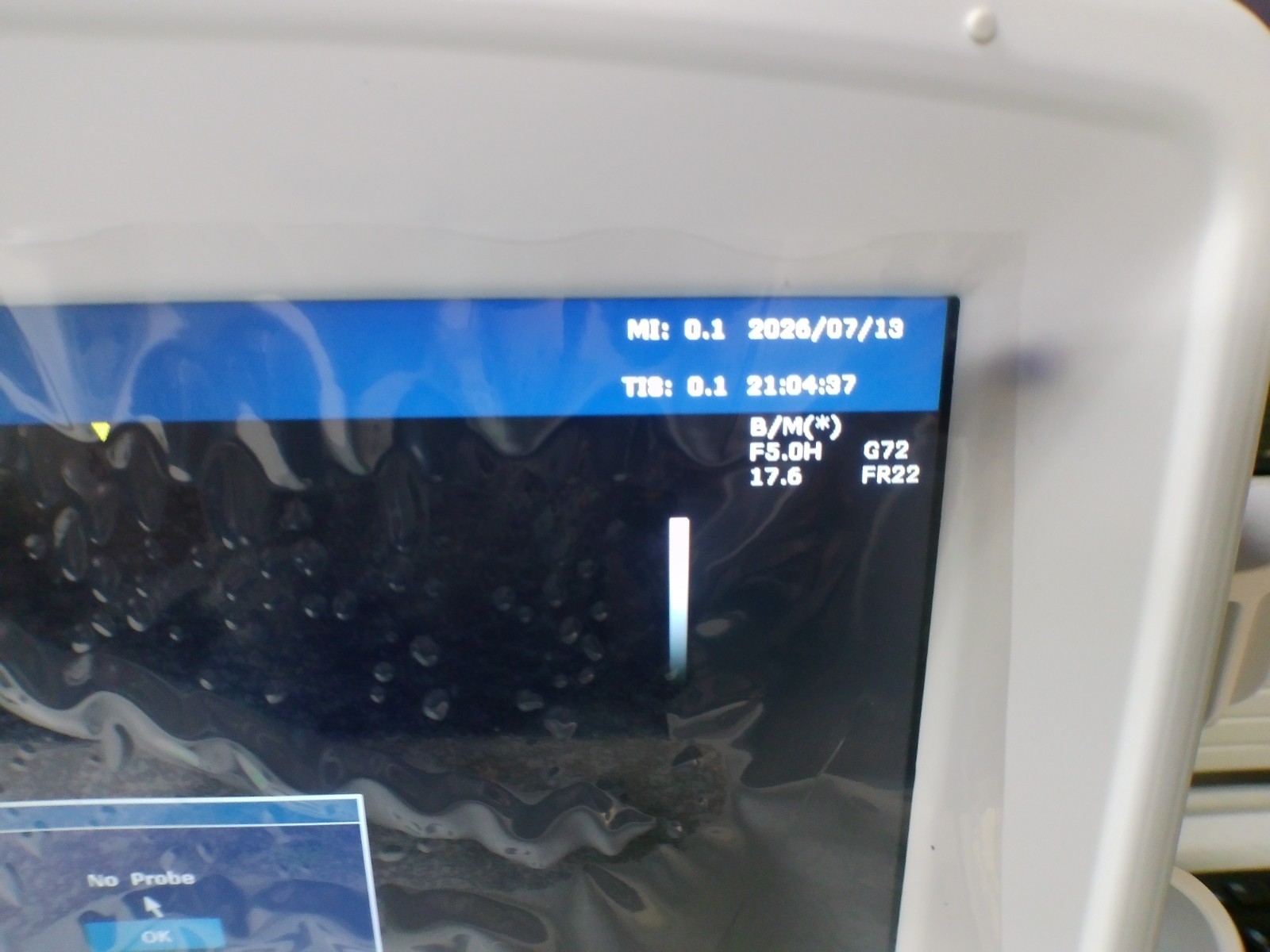 Edan U50 prime edition Diagnostic Ultrasound