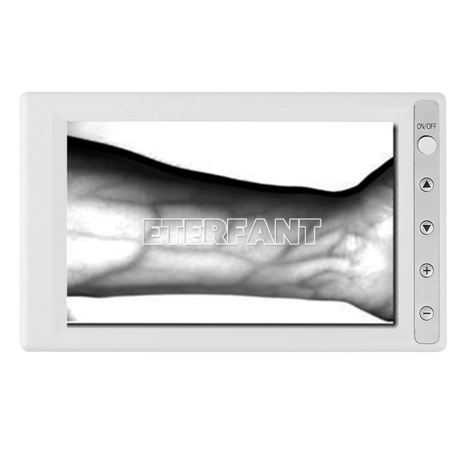 ETERFANT AV300 Vein Finder Blood Vessel Searching Machine 5.5” LCD Screen