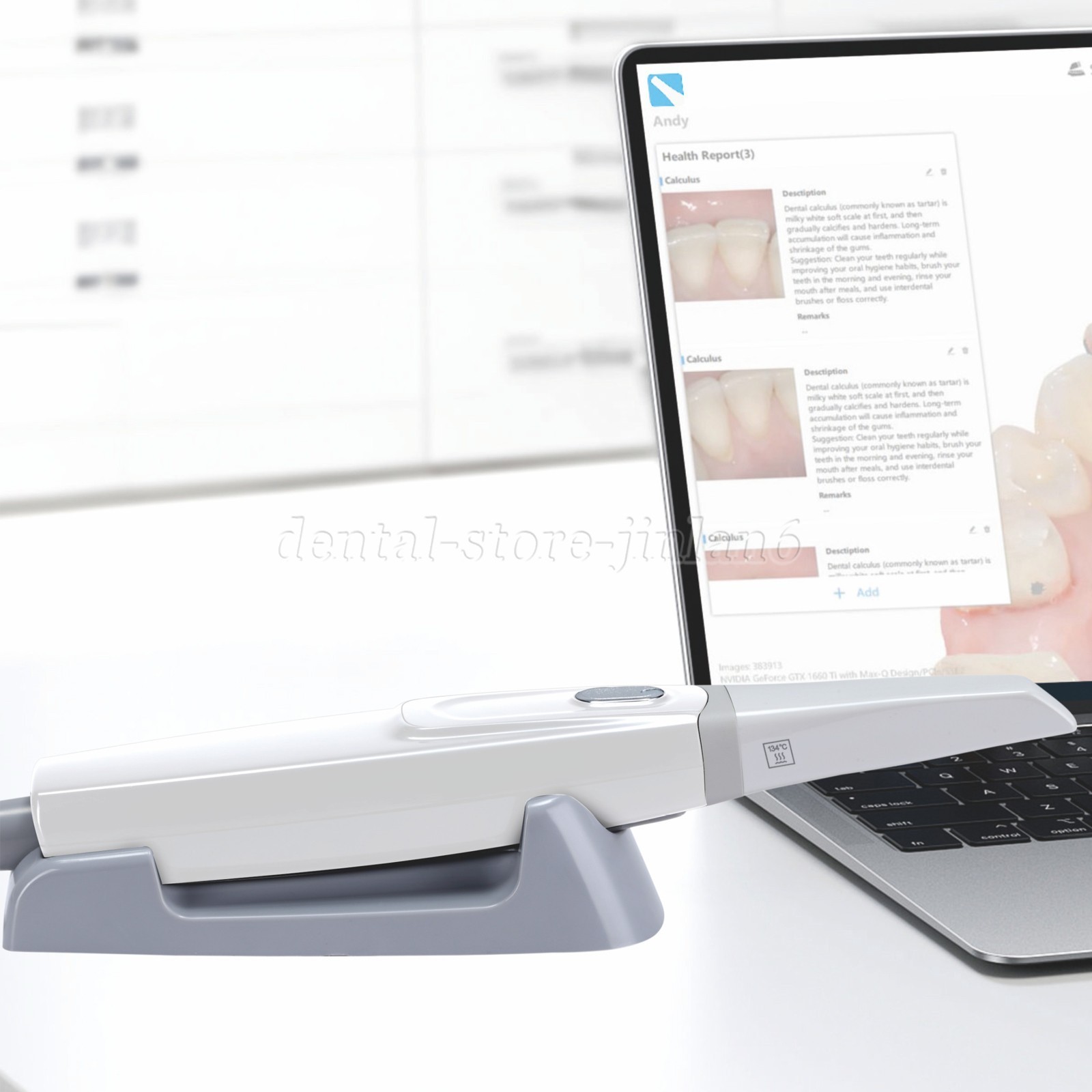 Factory Price 3D Oral Fast Speed Digital Dentist 3D Dental Intraoral Scanner