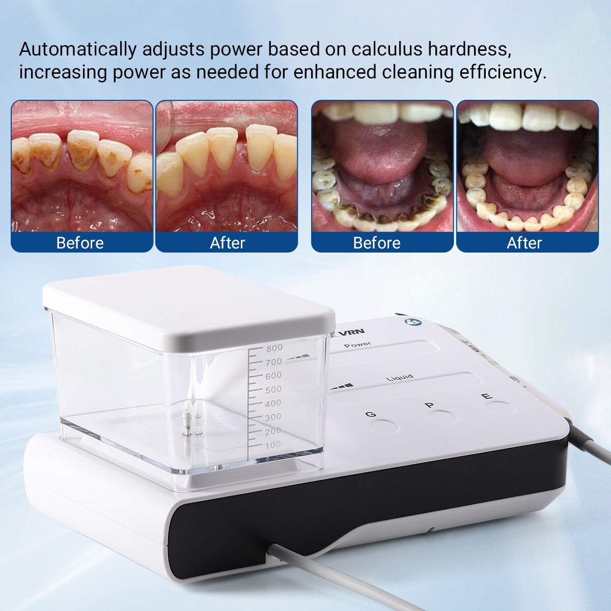 LED Dental Ultrasonic Piezo Scaler Handpiece Bottles Fit EMS Cavitron Woodpecker