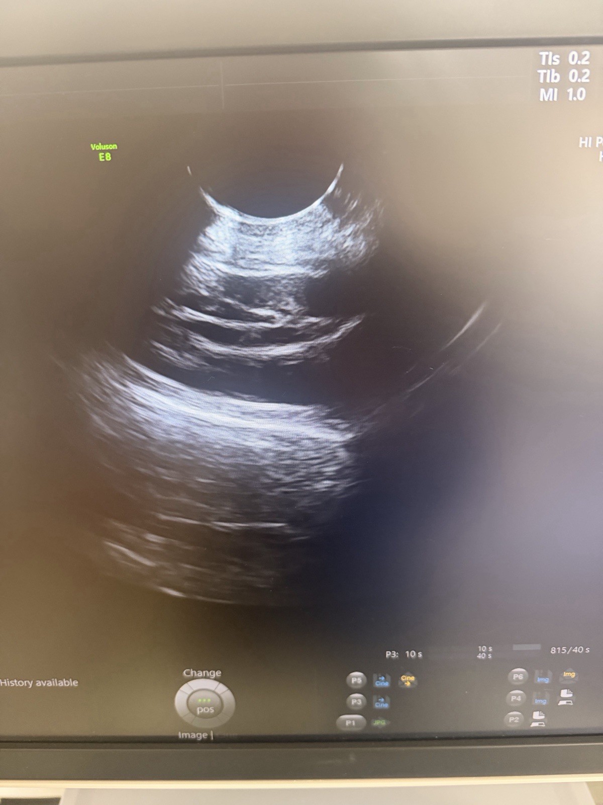 2020 GE Voluson E8 BT21 4D Ultrasound | HDlive | Free Probe | 90-Day Warranty