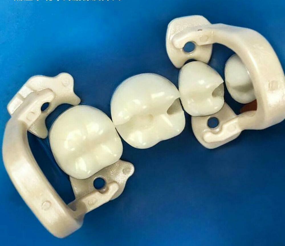Dental Barrier Clips Rubber Dam Clamps Clip Soft Resin Molar/Premolar Fit Kerr