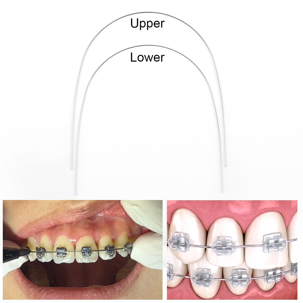 AZDENT Dental Orthodontic Niti Arch Wire Round Nature Form 10pcs/pack