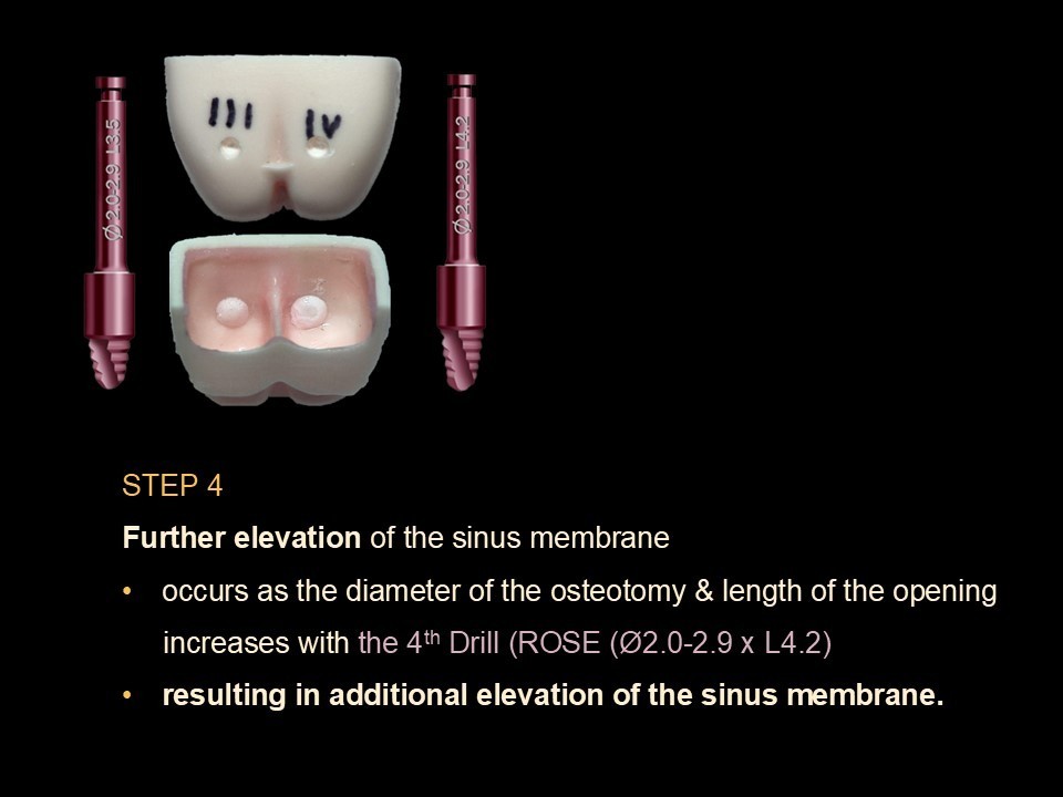 Lateral Window Sinus Elevation Drill Set, with elevator instrument set