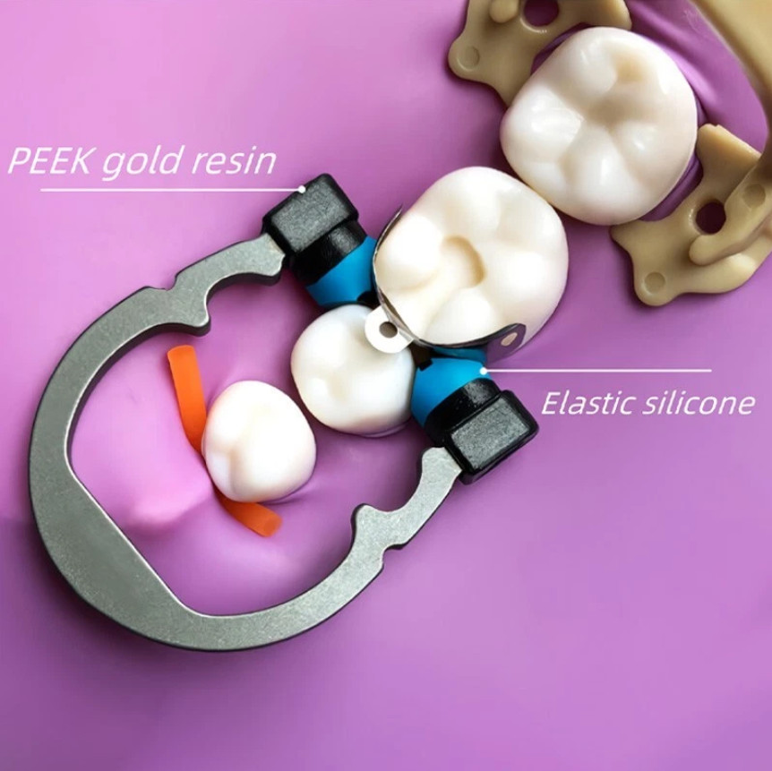 Dental Sectional Matrix System R5 Nickel Titanium Metal Matrices Clip Ring Clamp