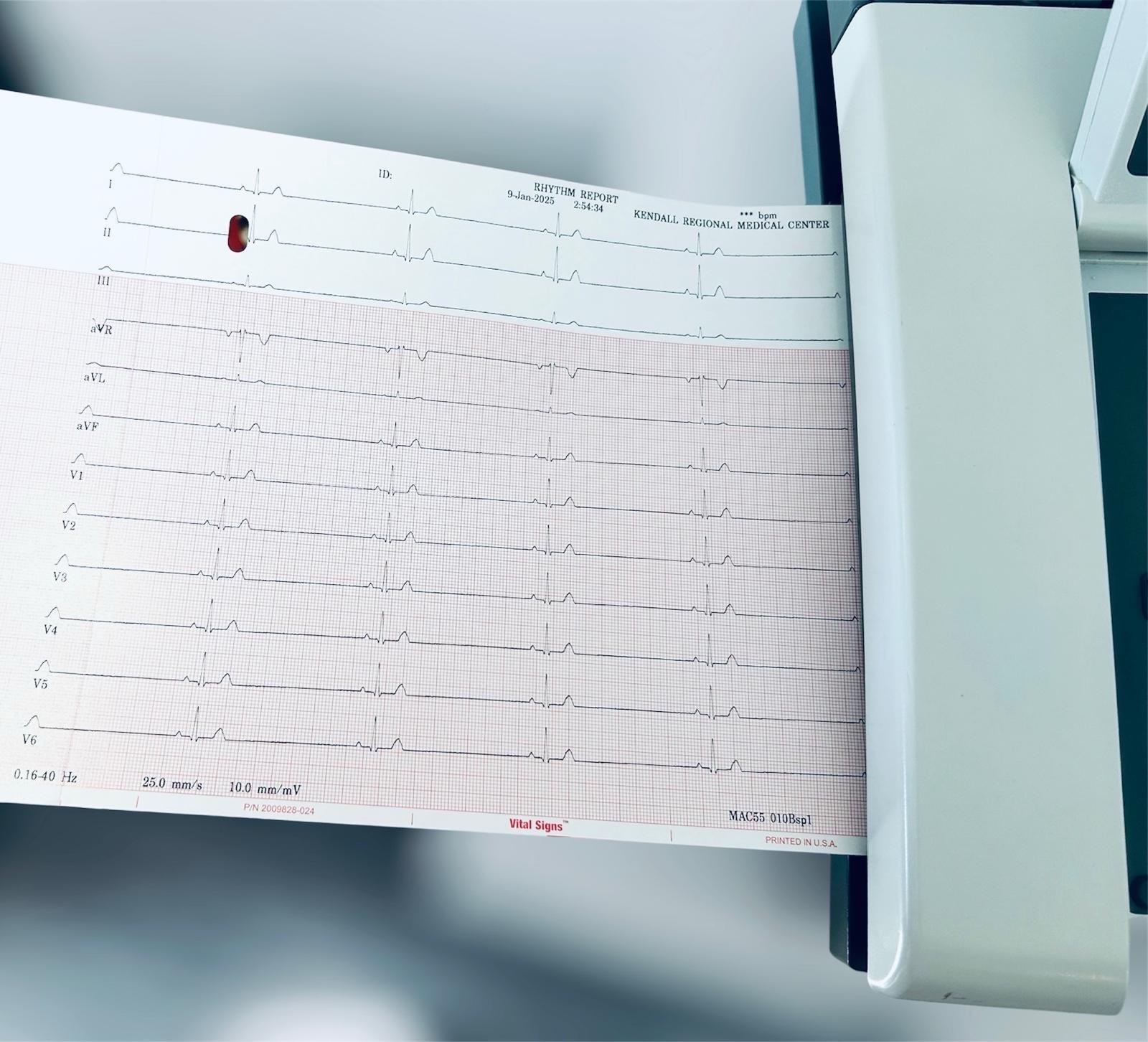 GE Healthcare MAC 5500 HD ECG with CAM Module