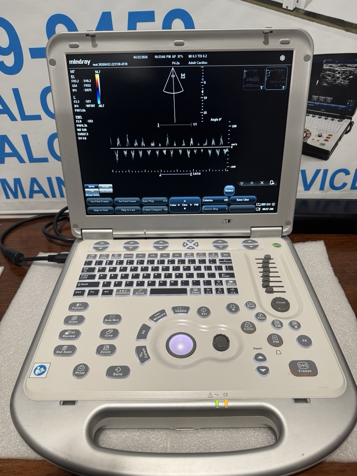 Mindray M7 With Linear Transducer 7L4S (YOU WILL RECEIVE WHAT IS IN THE PICTURE)