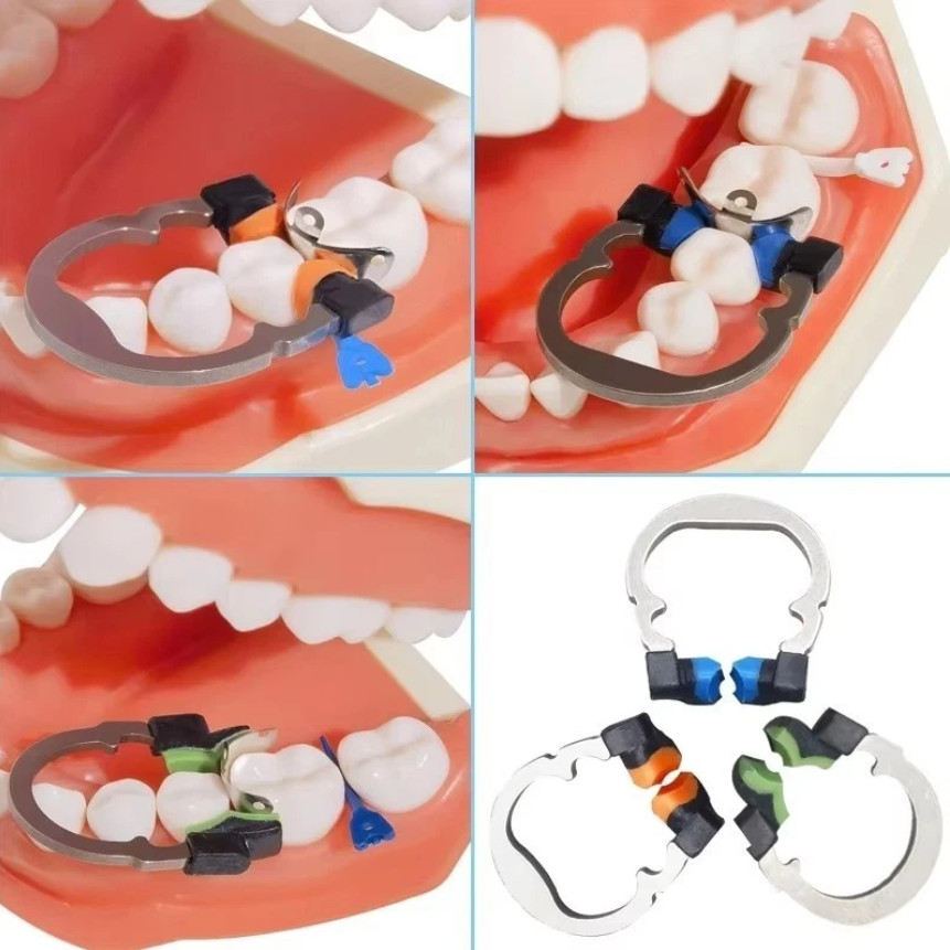 Dental Sectional Matrix System R5 Nickel Titanium Metal Matrices Clip Ring Clamp