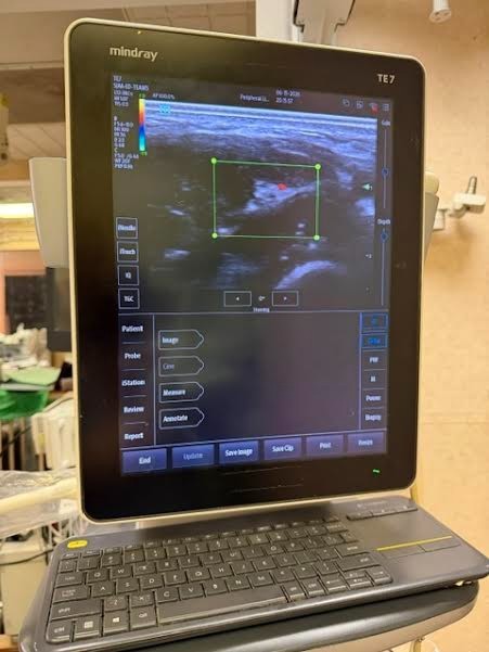 MINDRAY TE 7 ultrasound with two probes