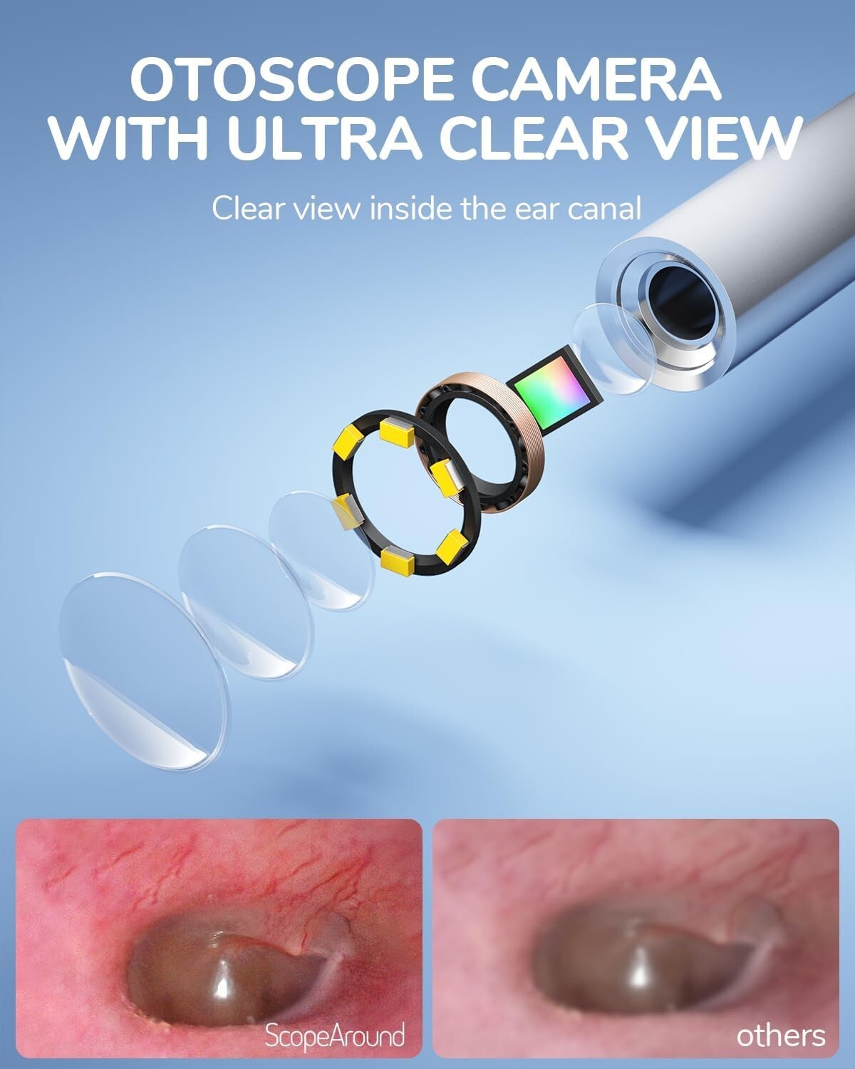 4.5-inch IPS Color Screen Digital Otoscope 1.0MP 1080P 3.9mm Camera 6 LED