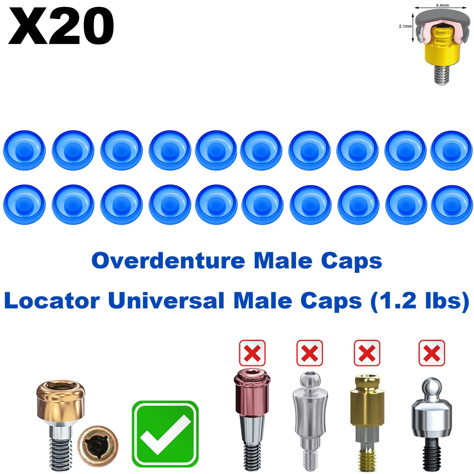 US 20Pcs Overdenture Abutment Retention Caps For Dental Locator Inserts Implant
