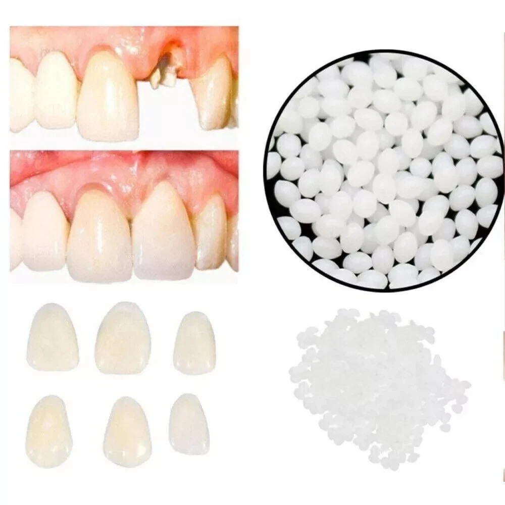Dental Thermal Beads Replacement Temporary 25g ﻿Tooth Denture False Repair Tool
