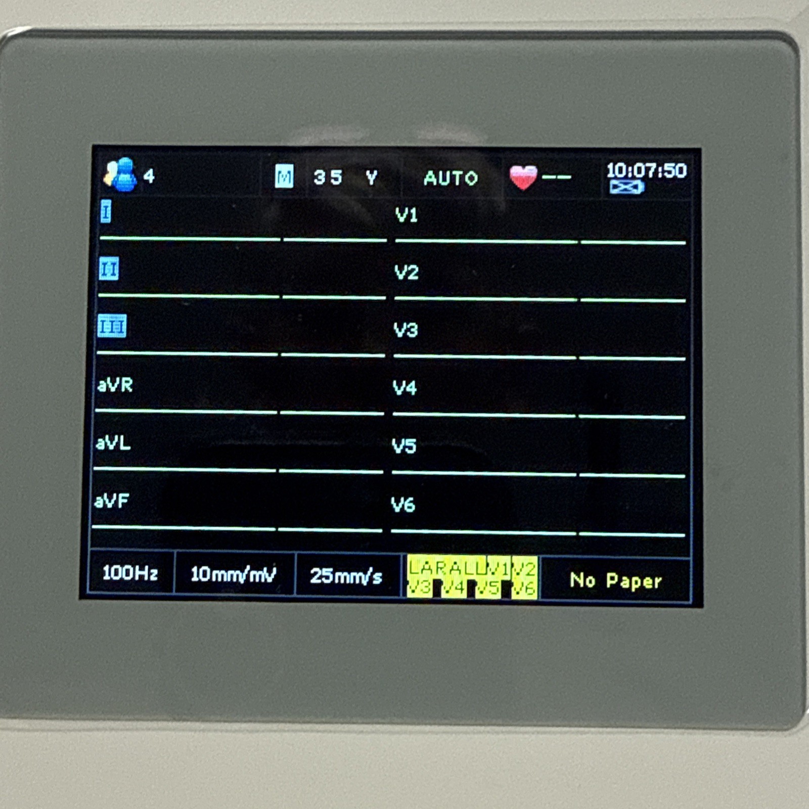 New Edan SE-3 Compact Portable Electrocardiograph ECG/EKG Machine 3Ch 12 Lead