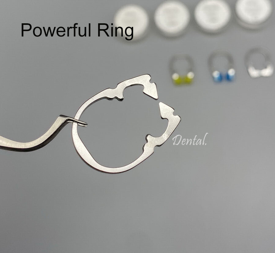Dental Sectional Contoured Matrix Ring Clamp Clips Standard Power Separator Ring