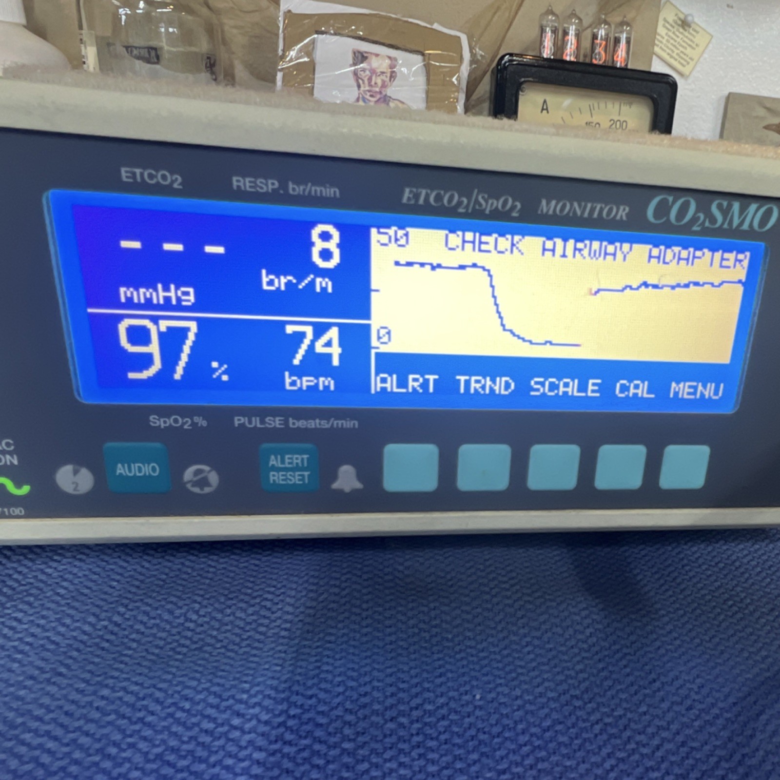 Novametrix CO2SMO 7100 ETCO2 SpO2 Respiration Monitor Battery Operated Printer