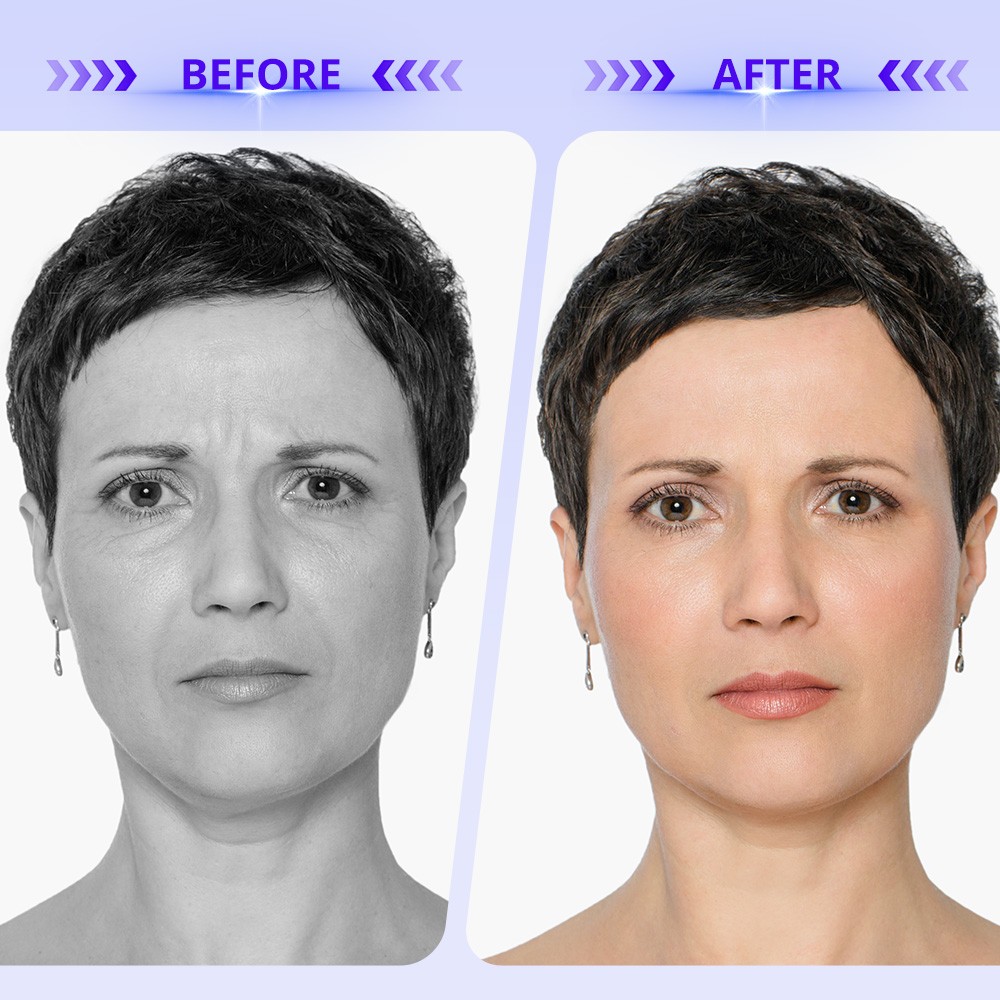 Elite 3 Attachments Beauty Machine for Boost Skin Firmness & Enhance Body Line