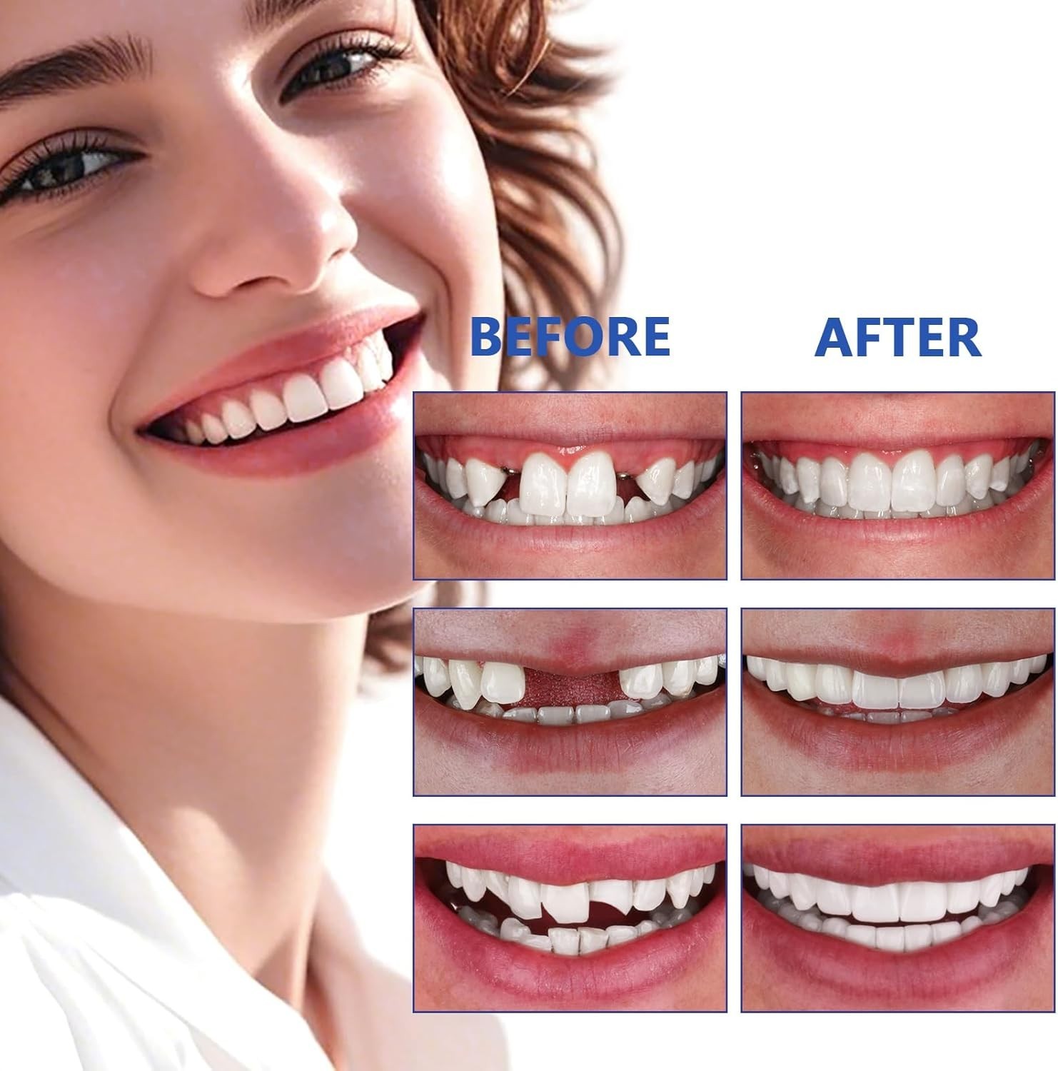 Moldable False Teeth Temporary Tooth Replacement Kit Fix Broken Missing Gap