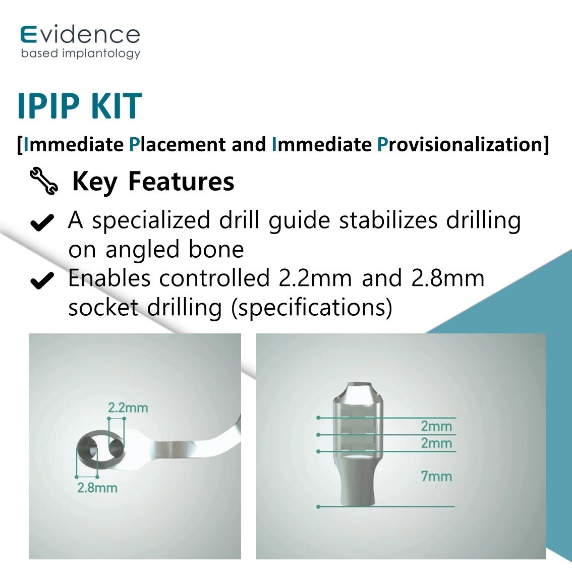 Evidence Implant IPIP Kit