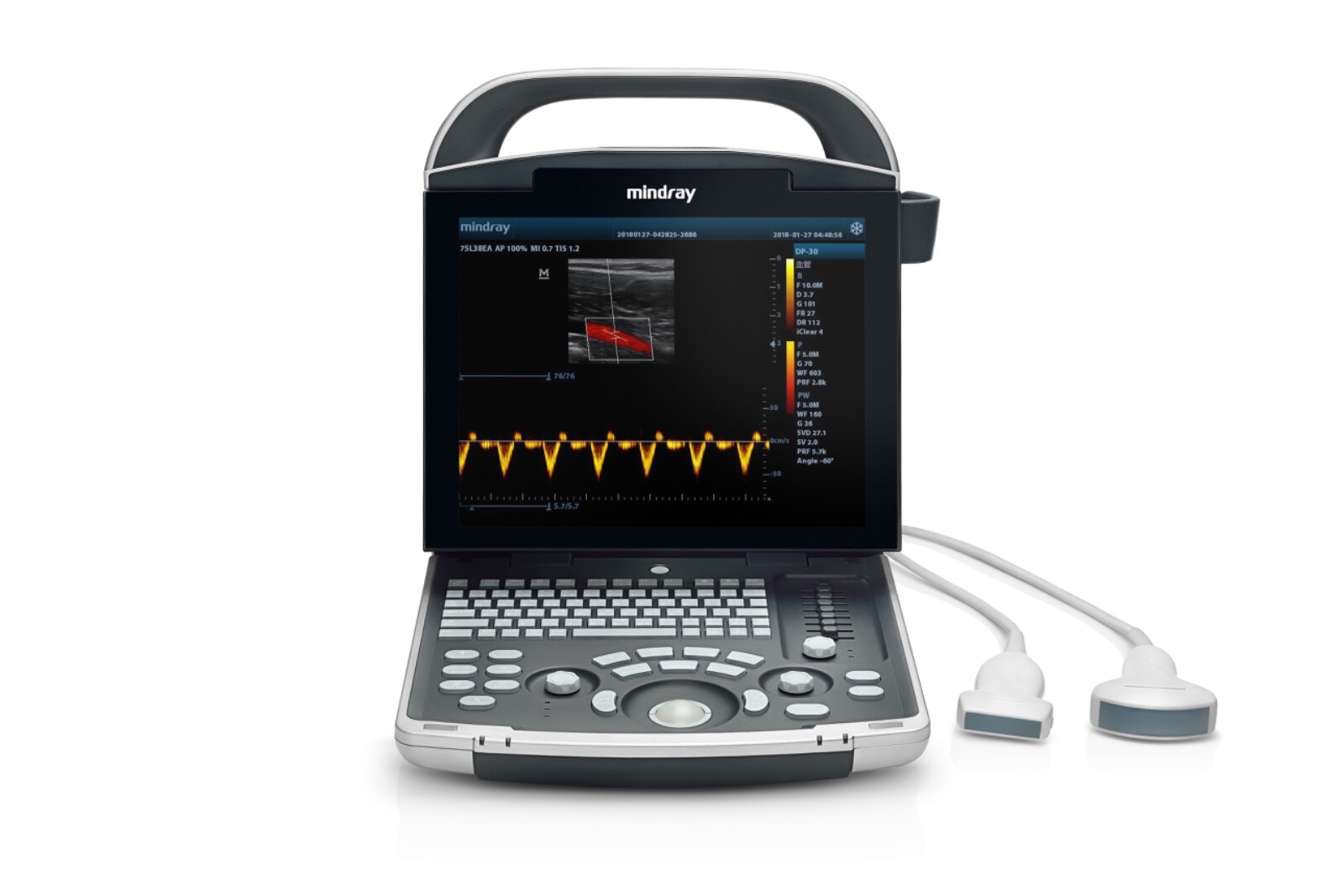 Mindray DP50 Vet Ultrasound with Micro Convex Probe 65C15EAV, Pets, Small Animal