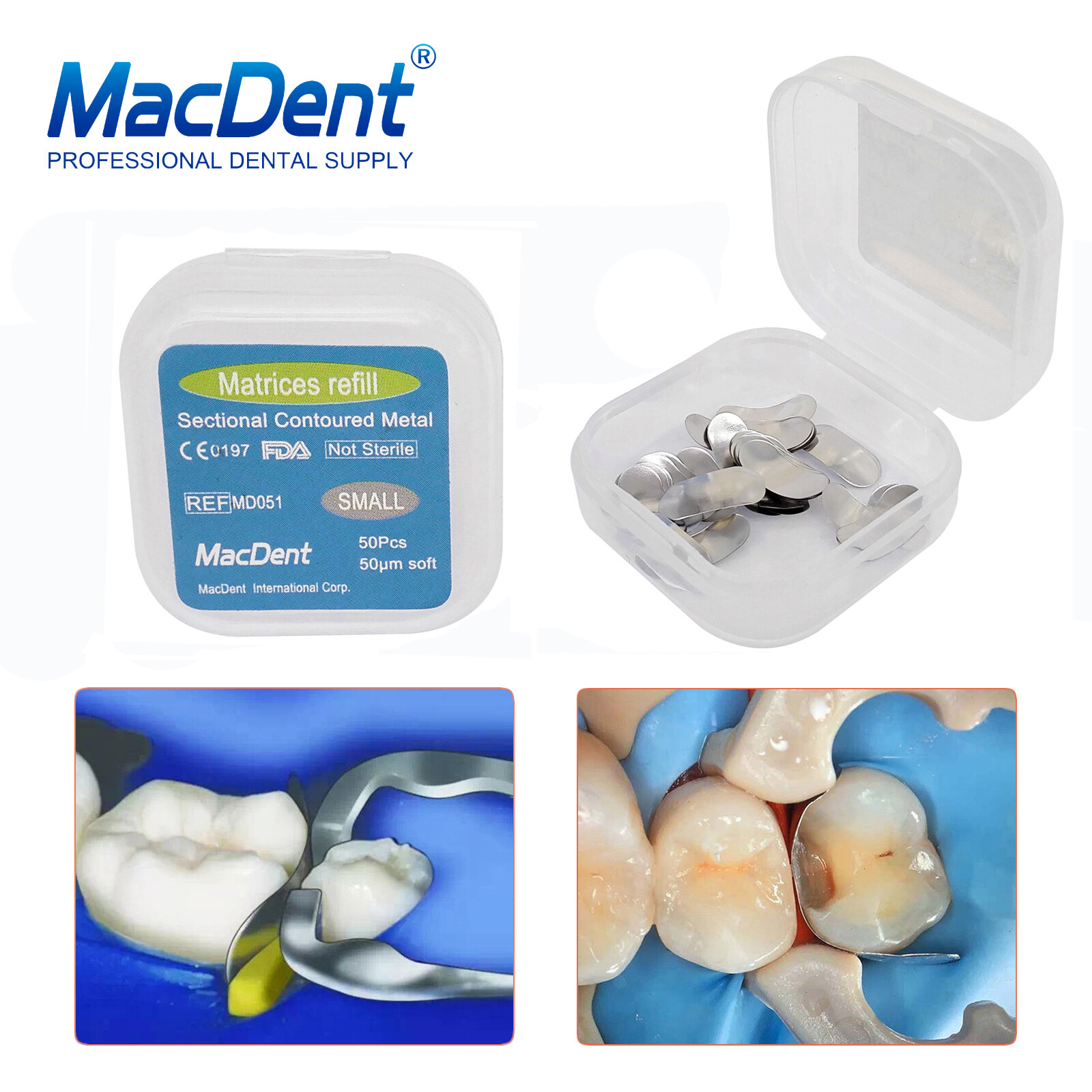 Dental Sectional Matrix System Contoured Metal Matrices Refill Matrix Bands 50x