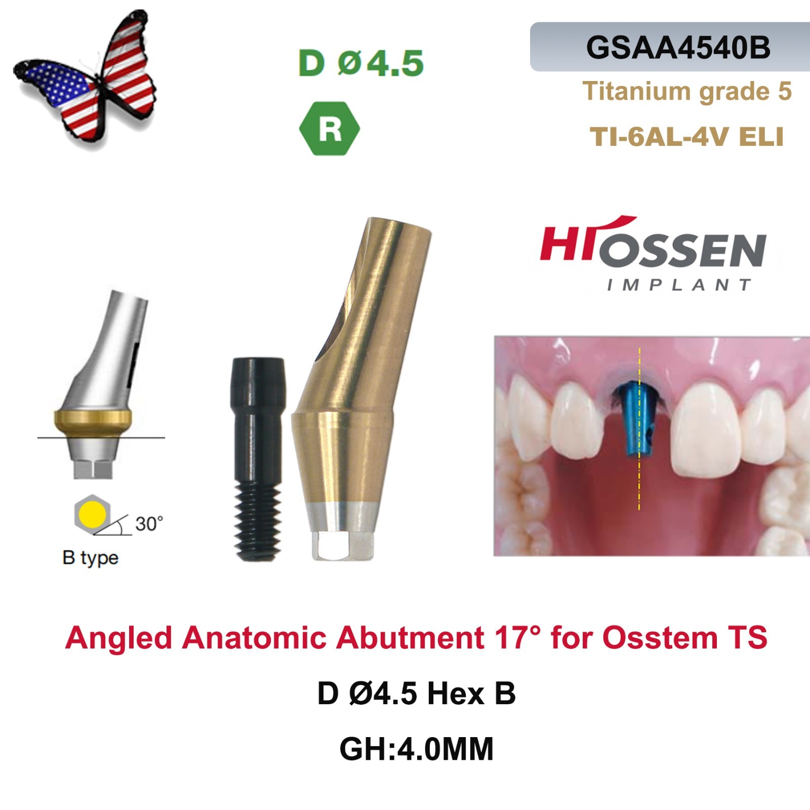 US 17° Angulated Abutment Regular Hex A/B Type For Osstem TS Regular Platform Ti
