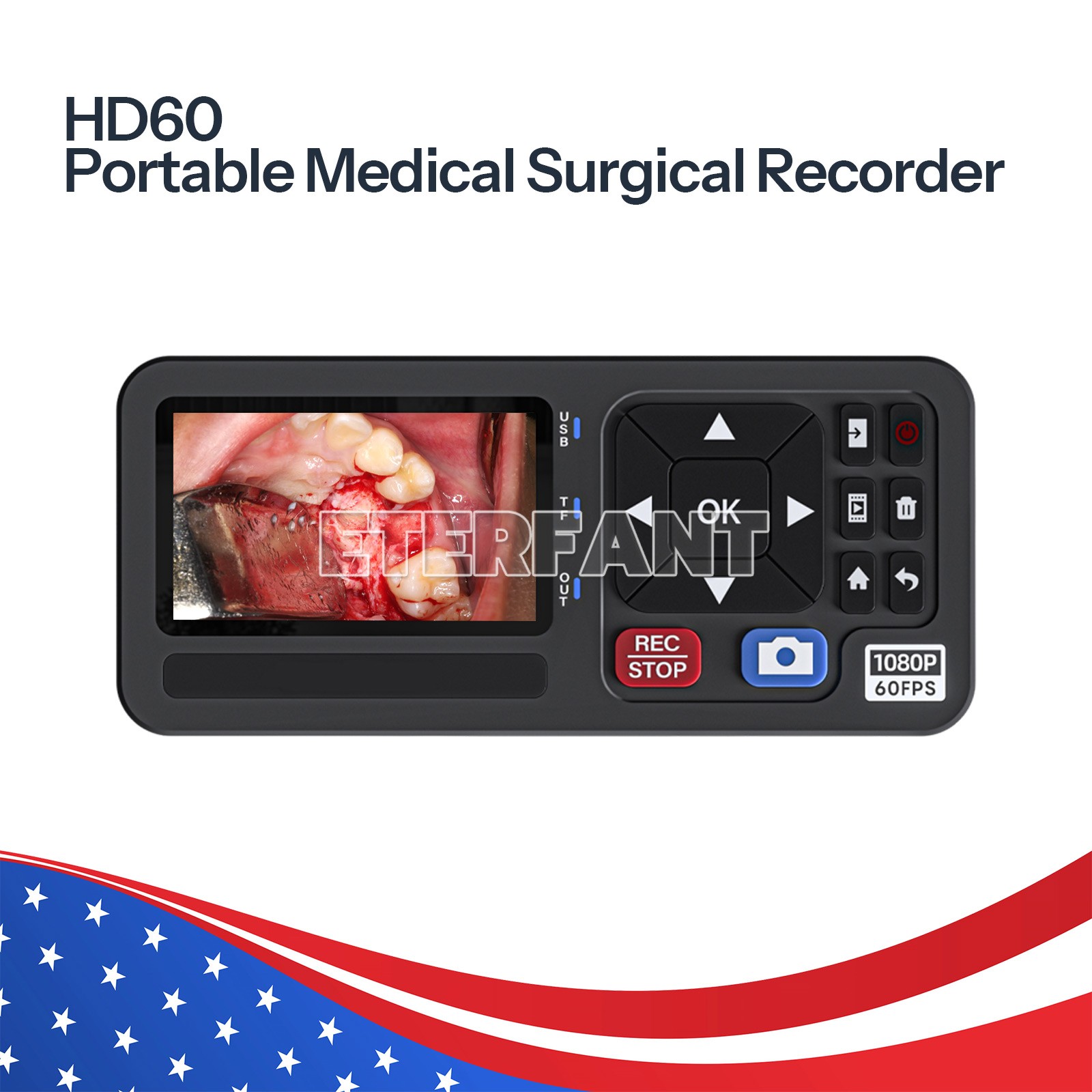 ETERFANT Medical Portable Surgical Recorder for Laparoscopy&Endoscopy Capture US