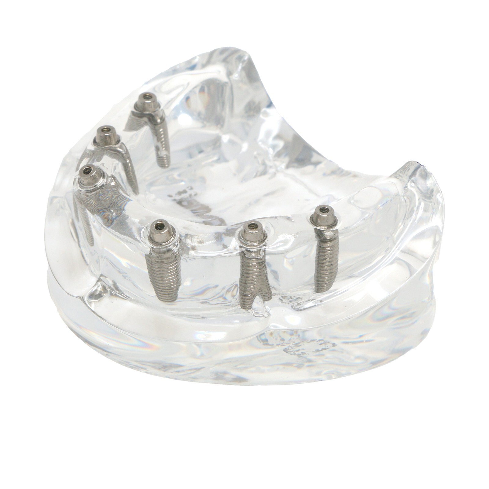 All-on-4/6 Screws Restoration Overdenture Dental Implant Model Upper/Lower Jaw