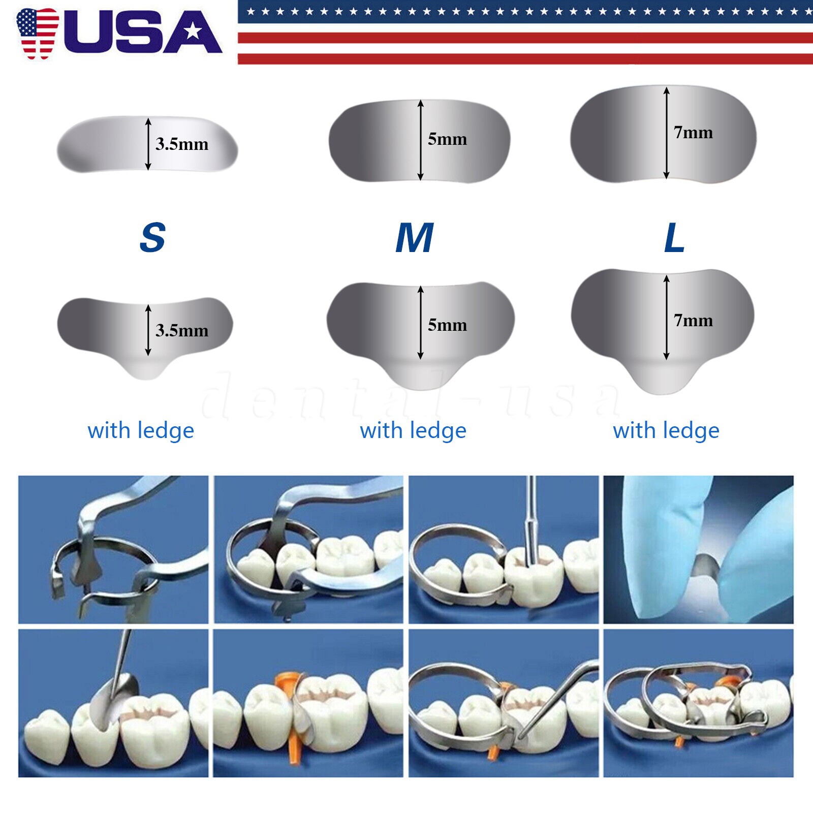 Dental Metal Matrices Matrix Band Sectional Contoured Refill S/M/L 50Pcs/1Pack