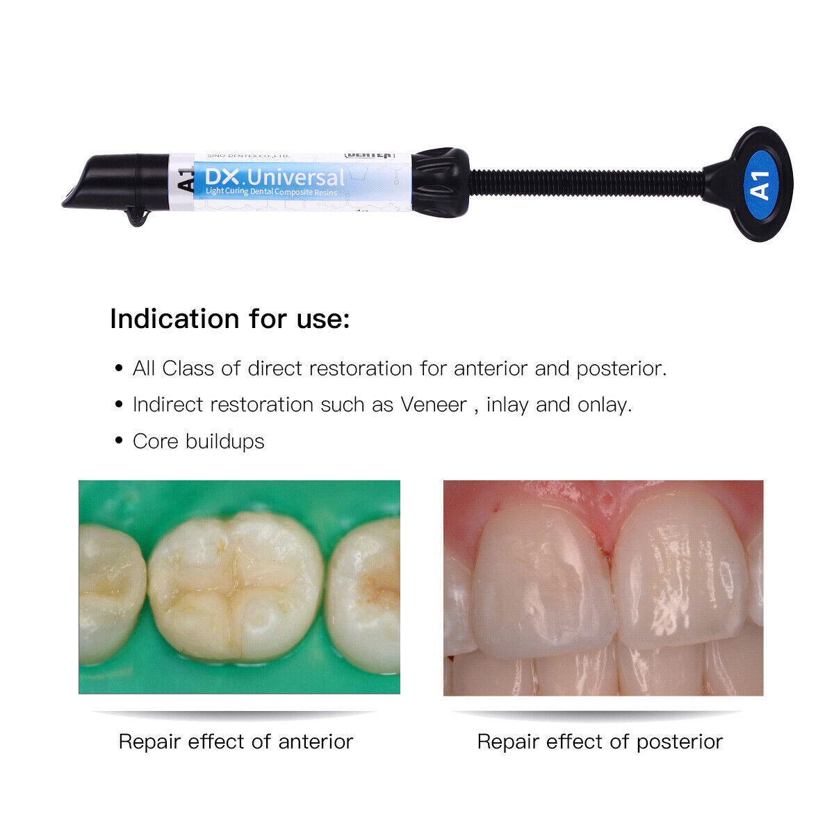 Dental Wireless LED Curing Light 1 Second Cure Lamp / Light Cure Composite Resin