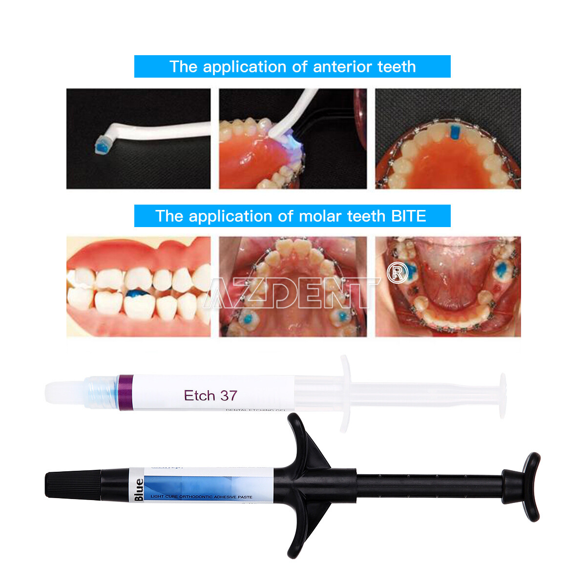 Dentex Dental Light Cure Orthodontic Adhesive Kit Blue bonding Bracket Braces