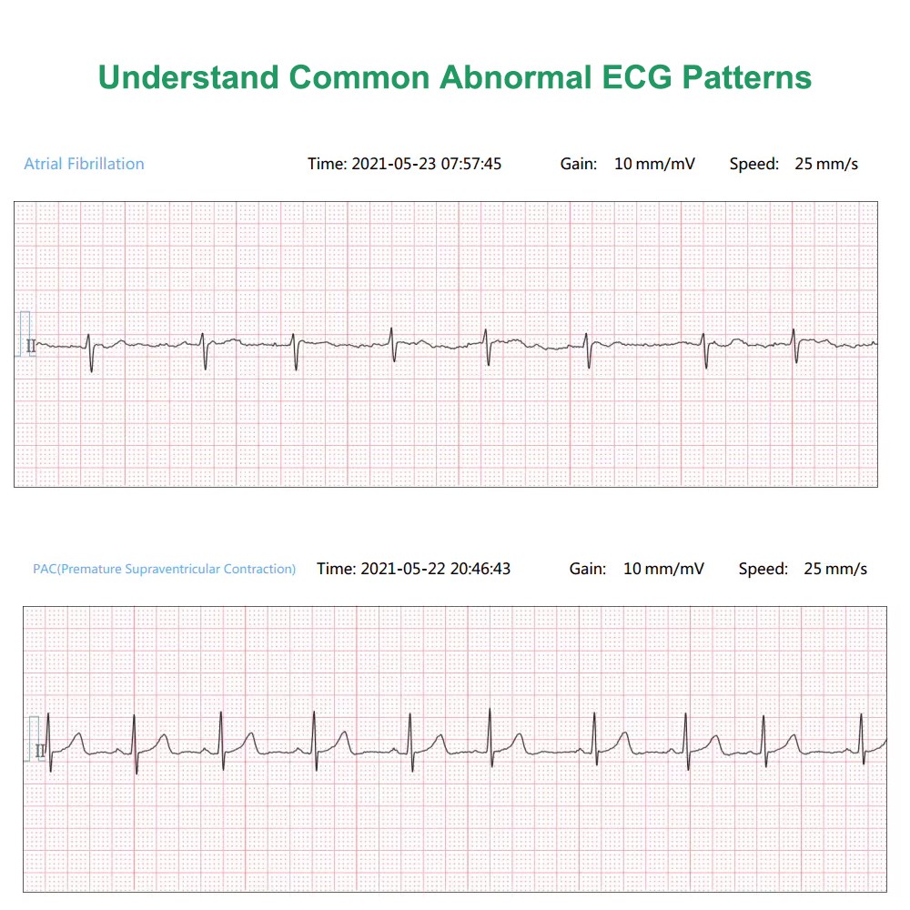 12 lead Holter Monitor 24h Portable with AI analysis software for Mac & Windows