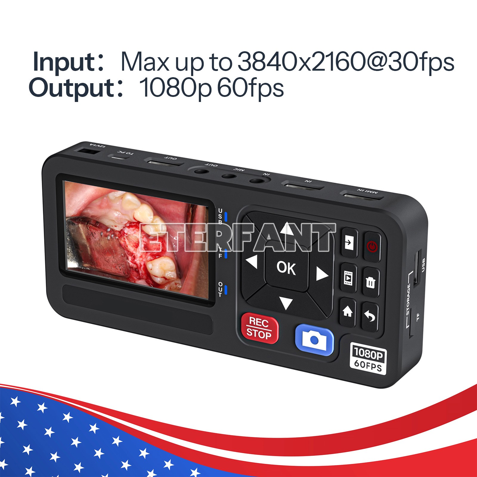ETERFANT Medical Portable Surgical Recorder for Laparoscopy&Endoscopy Capture US
