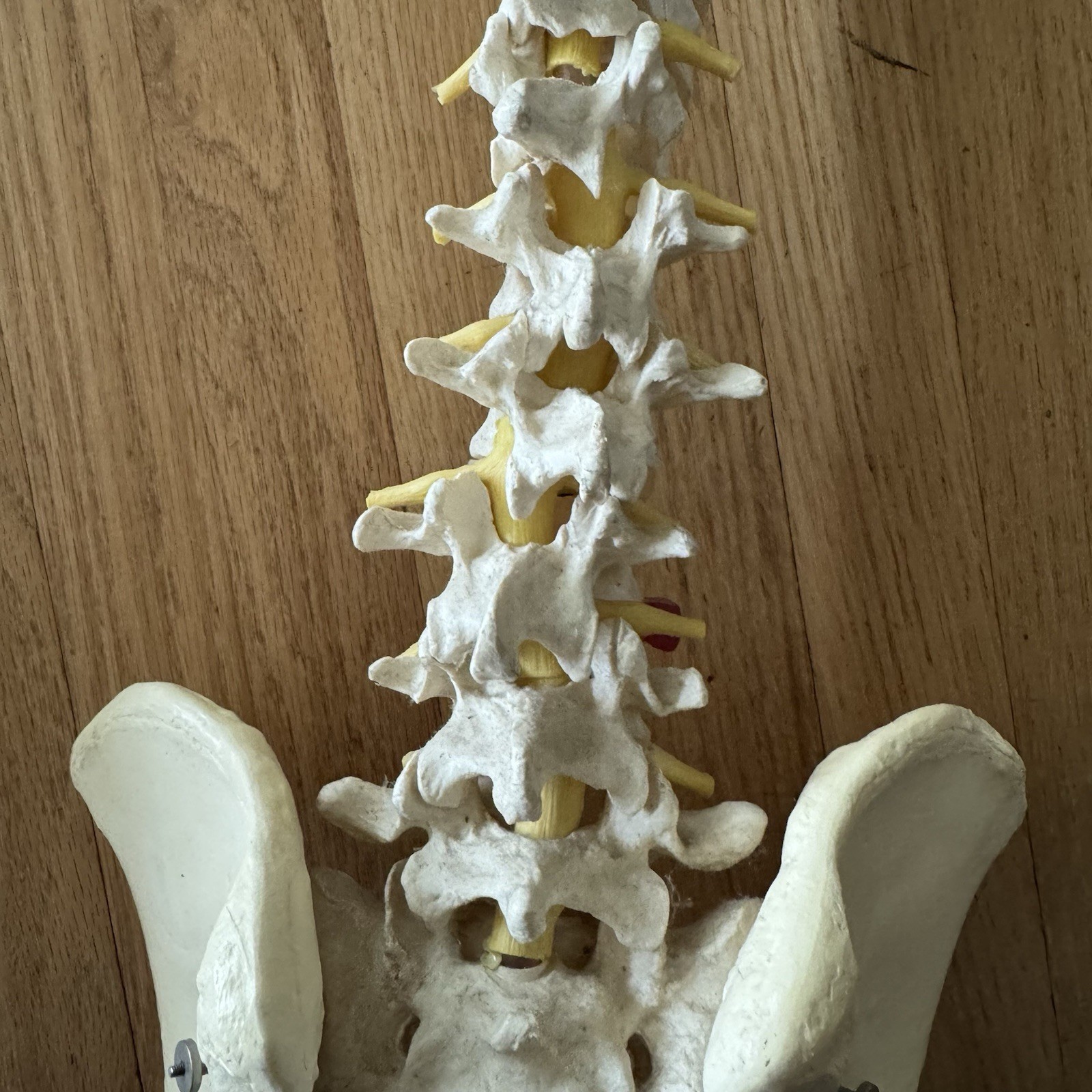 MEDICAL MODEL SPINE BACKBONE WITH PELVIS HIPS ADULT SIZE GERMANY SCIENTIFIC