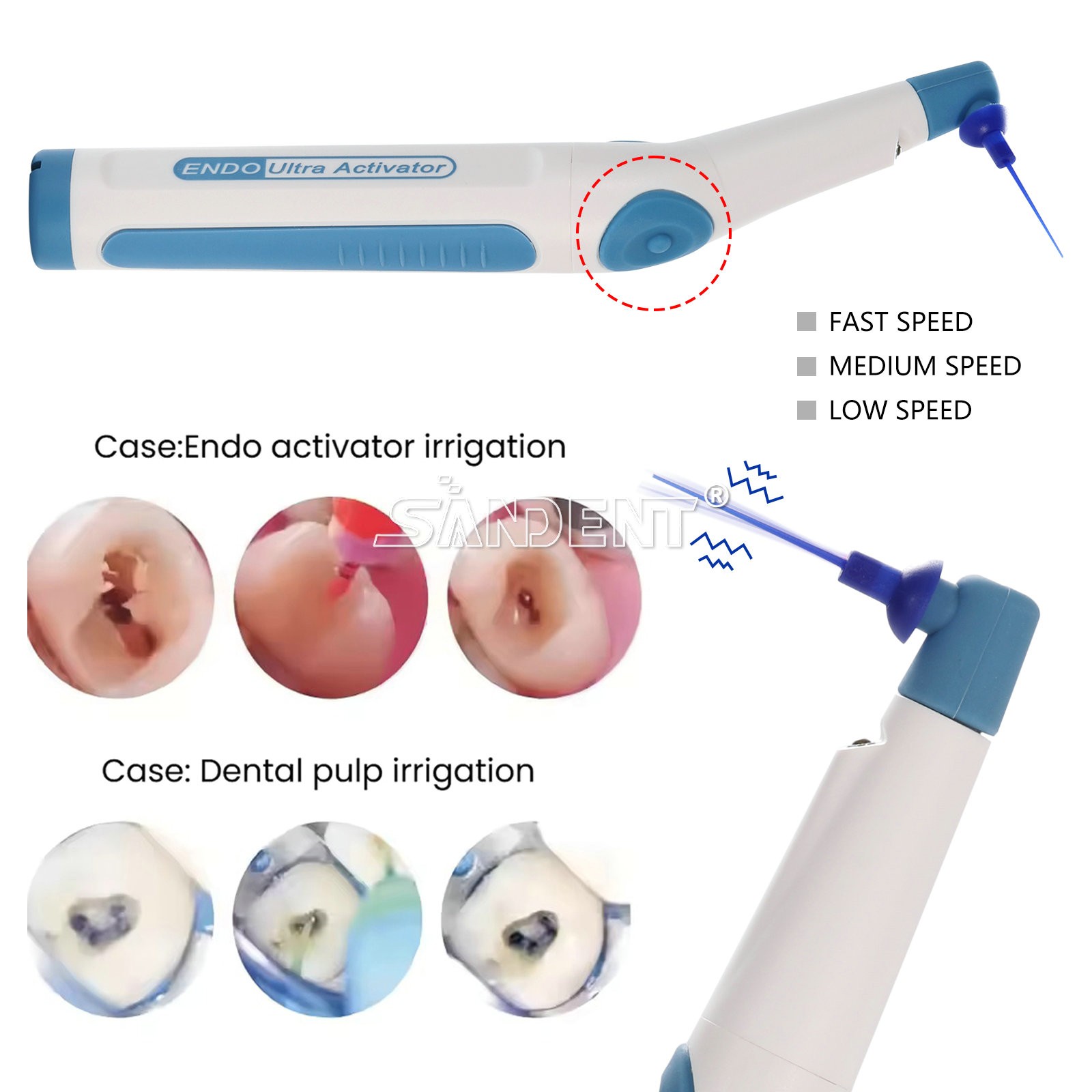 Dental Endodoncia Irrigator Endo Ultra Sonic Activator Root Canal 150 Tips Free