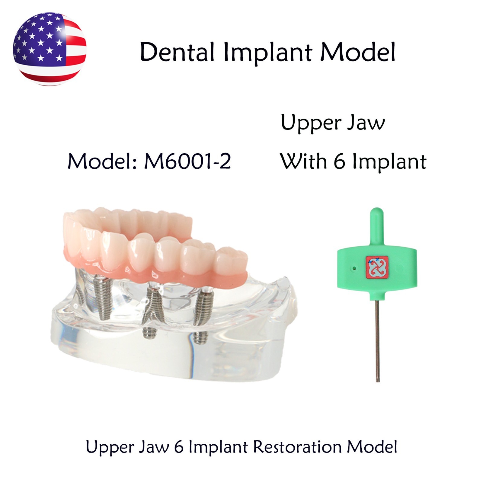 US Dental Implant Overdenture Model All-on-4/6 Upper Jaw Restoration 4/6 Screws