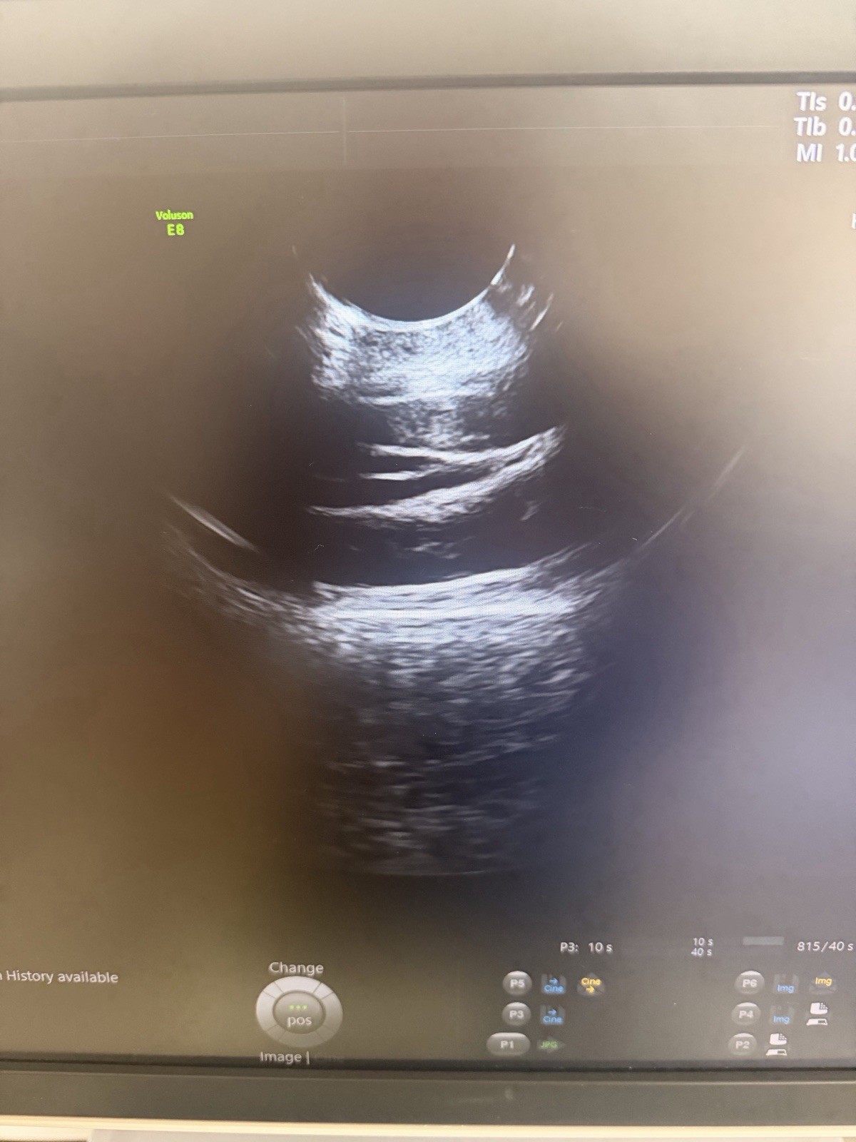 2020 GE Voluson E8 BT21 4D Ultrasound | HDlive | Free Probe | 90-Day Warranty