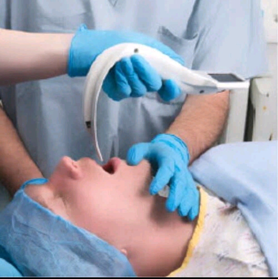 Video Laryngoscope I-View New Sealed