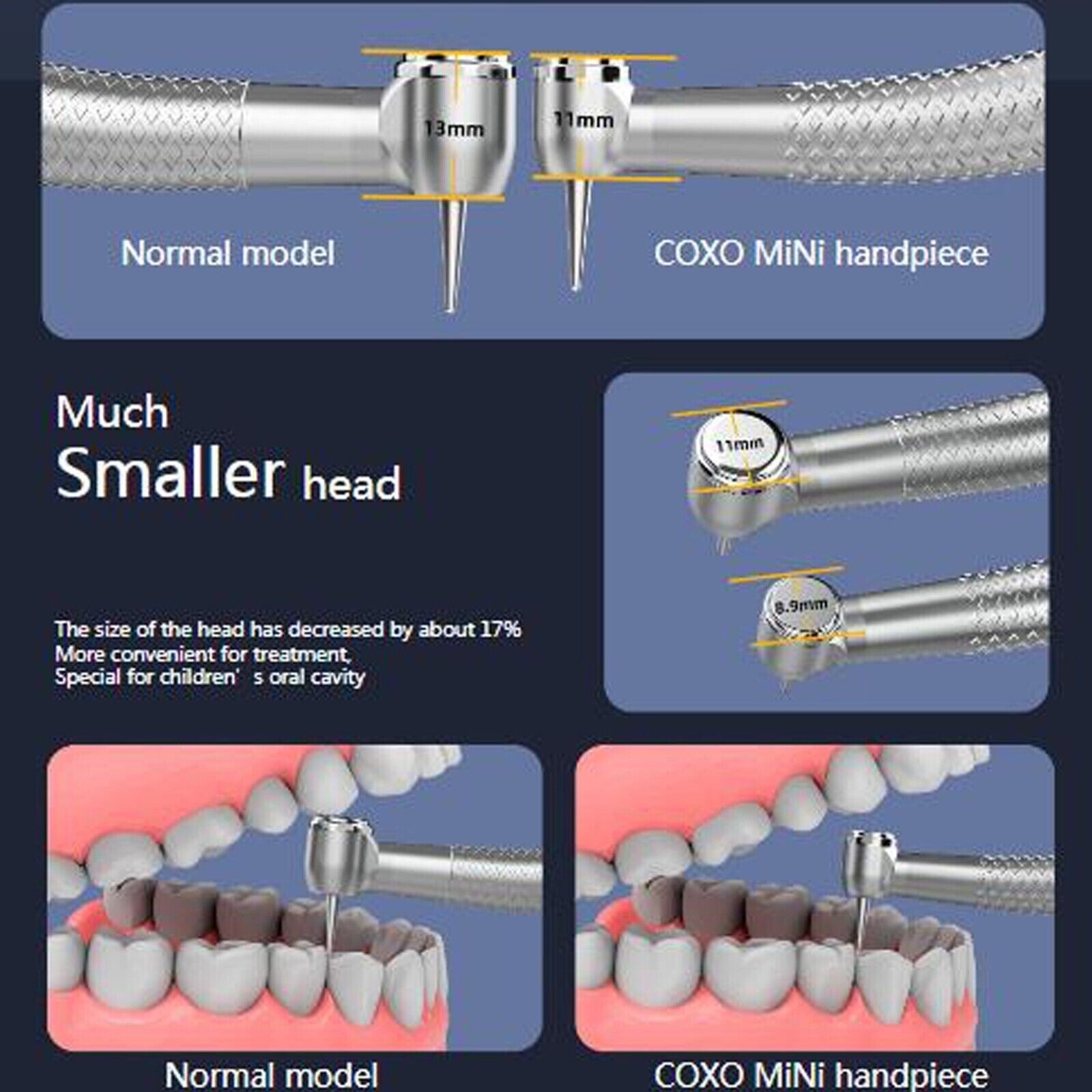 COXO Dental Small Mini Head LED Handpiece High Speed Air Turbine 4 Hole NSK Kids