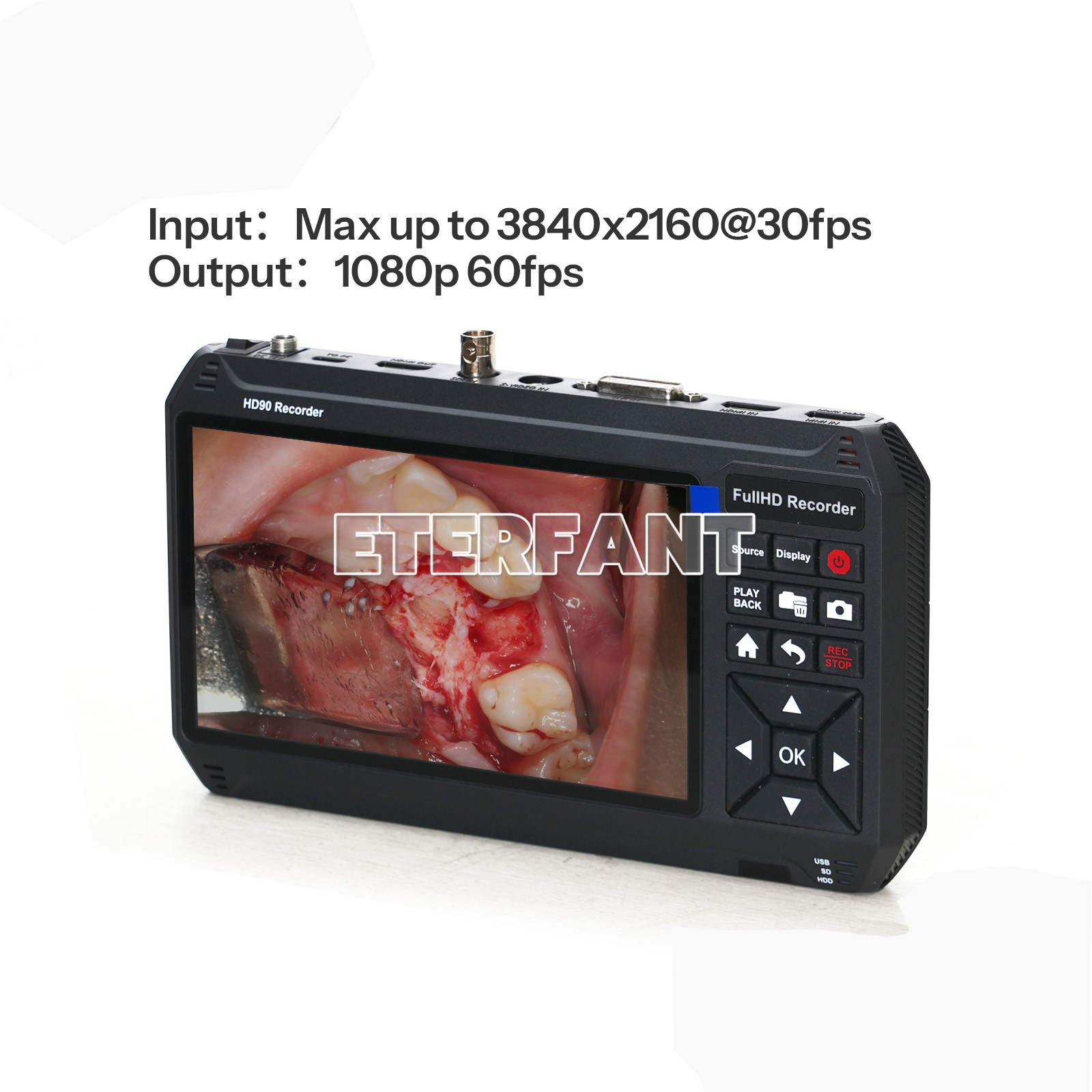 1080p 60Hz HD90 Portable Medical Surgical Recorder for Laparoscopy and Endoscopy