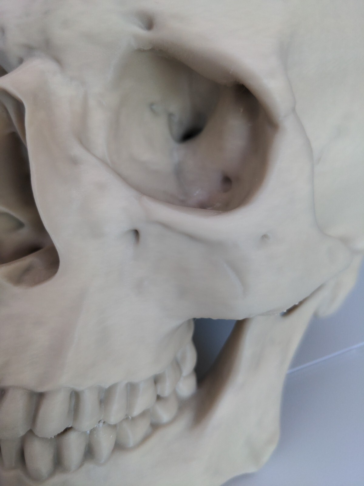 Anatomically Correct Human Skull 3d Printed!