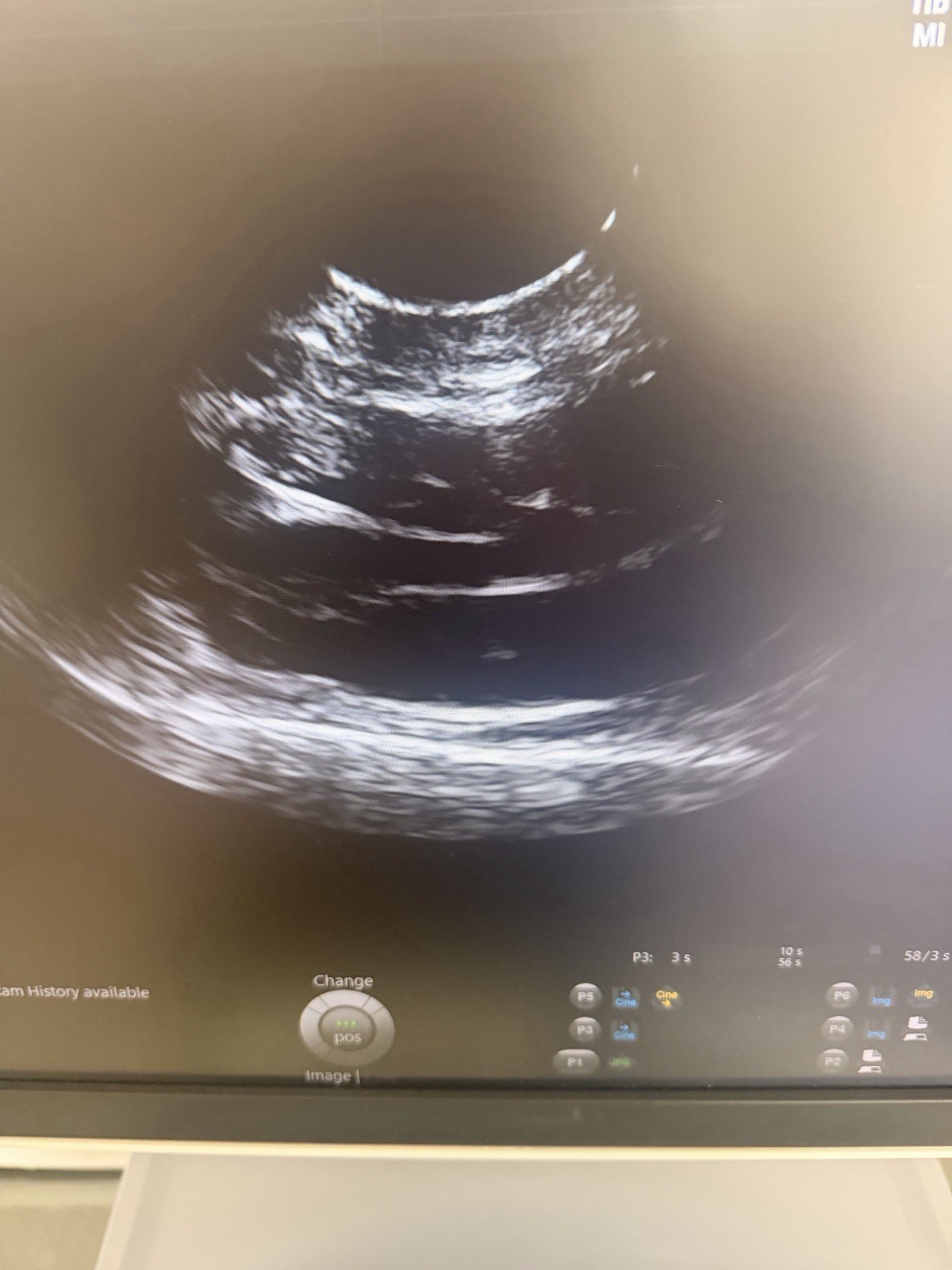 2020 GE Voluson E8 BT21 4D Ultrasound | HDlive | Free Probe | 90-Day Warranty