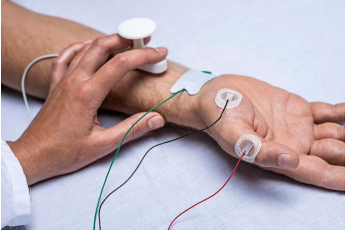 Ambu Neuroline 715 Surface Electrode