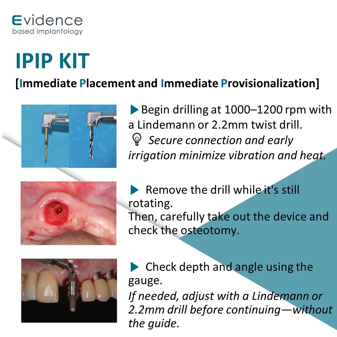 Evidence Implant IPIP Kit