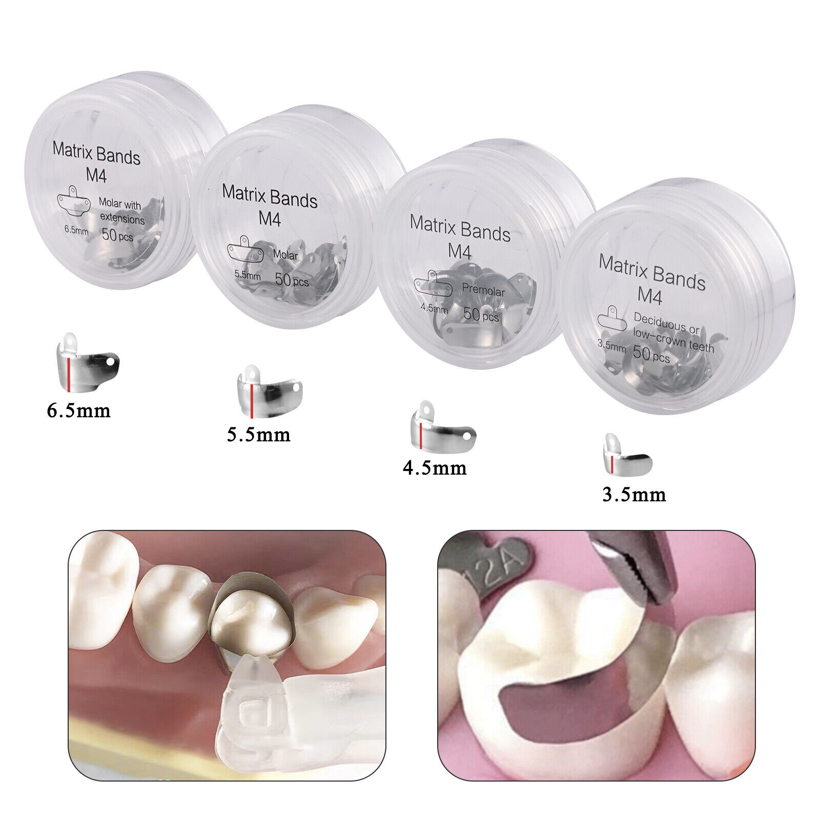 Dental Matrix Bands Sectional Matrice Titanium Clamp Fit Garrison Palodent V3