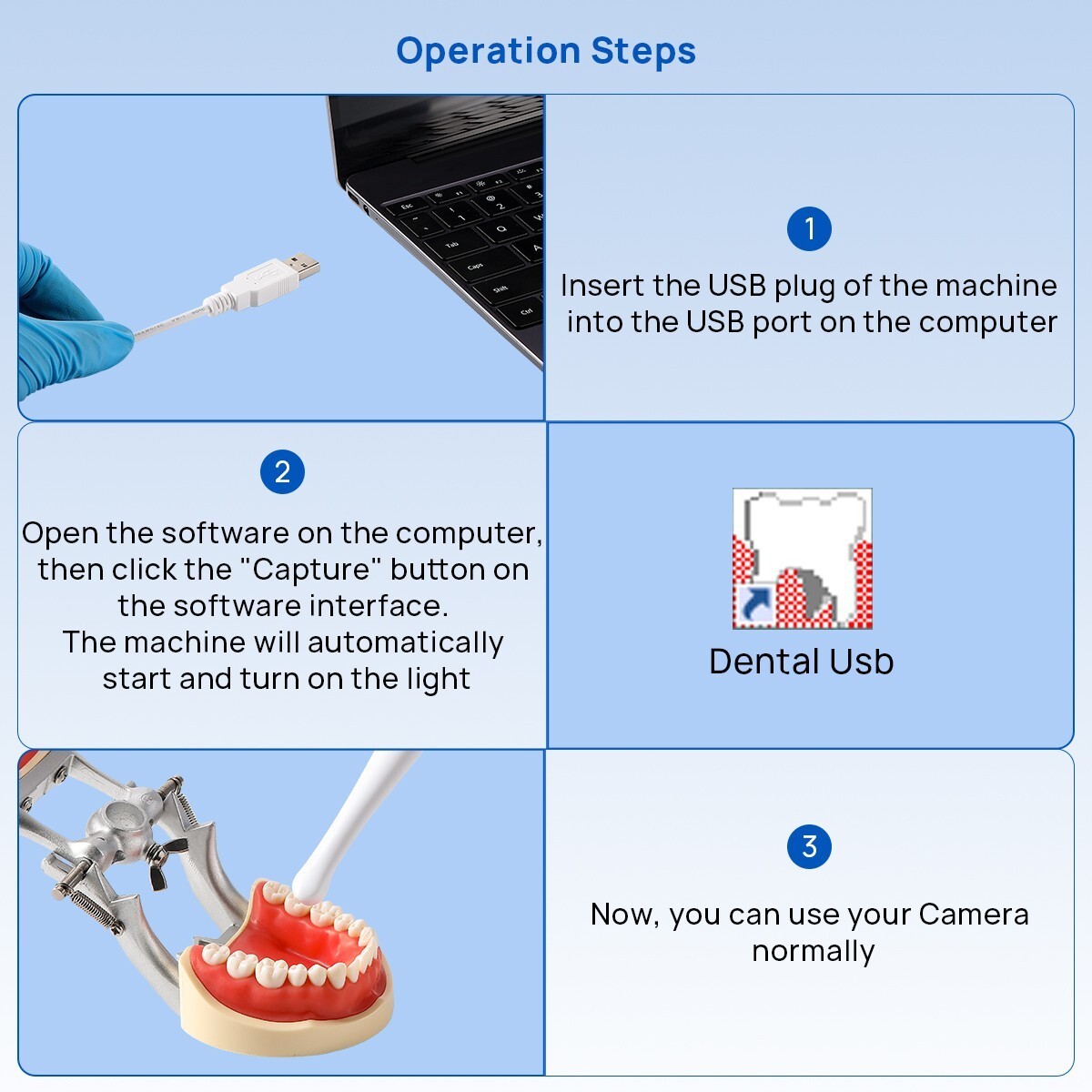 AZDENT Dental Intra Oral Camera USB Digital Imaging Intraoral Endoscope 6 LED